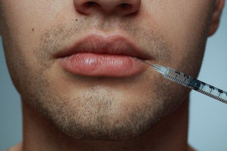 Preenchimento Labial Masculino: Tudo o Que Você Precisa Saber para Realçar Seu Sorriso