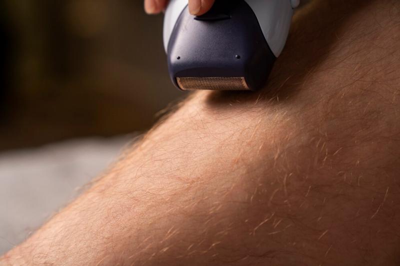 Depilação a Laser para Pernas Masculinas: Vantagens e Como Funciona Depilação a Laser para Pernas Masculinas: Vantagens e Como Funciona