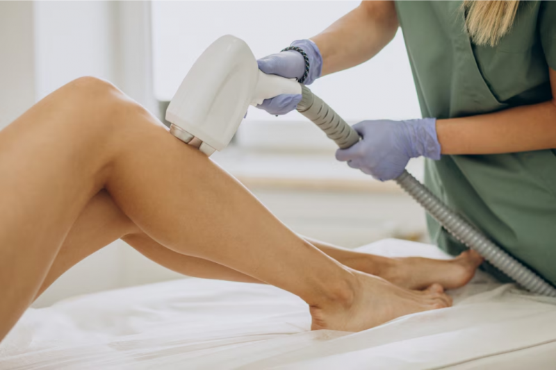 Depilação a Laser Perianal como Alternativa Eficiente e Segura Depilação a Laser Perianal como Alternativa Eficiente e Segura