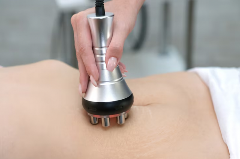 Descubra Como a Radiofrequência Combate a Celulite de Forma Eficaz Descubra Como a Radiofrequência Combate a Celulite de Forma Eficaz