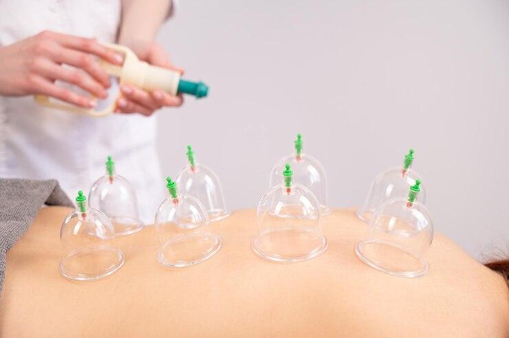 Massagem de Ventosa: Benefícios e Técnicas Reveladas Massagem de Ventosa: Benefícios e Técnicas Reveladas