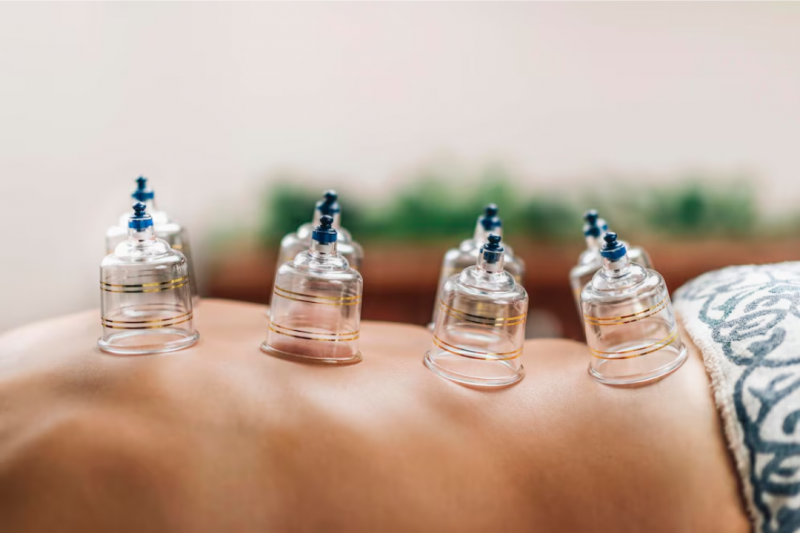 Massagem Relaxante com Ventosaterapia: Benefícios e Técnicas Essenciais Massagem Relaxante com Ventosaterapia: Benefícios e Técnicas Essenciais
