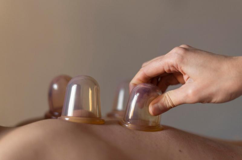 Os Benefícios da Massagem de Ventosa para a Saúde e Bem-Estar Os Benefícios da Massagem de Ventosa para a Saúde e Bem-Estar