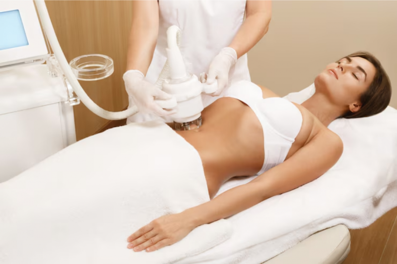 Radiofrequência barriga é a solução eficaz para eliminar gordura e flacidez na região abdominal Radiofrequência barriga é a solução eficaz para eliminar gordura e flacidez na região abdominal