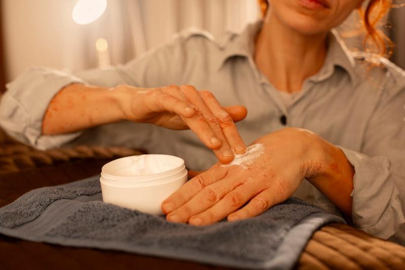 Tratamento para Mãos Envelhecidas Como Rejuvenescer a Sua Pele Tratamento para Mãos Envelhecidas Como Rejuvenescer a Sua Pele