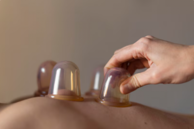 Massagem de Ventosa: Benefícios e Como Praticar Massagem de Ventosa: Benefícios e Como Praticar