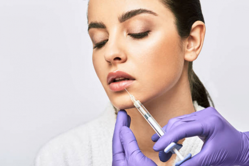 Aplicação de Botox Facial Agendar Belvedere - Aplicação de Botox nos Lábios