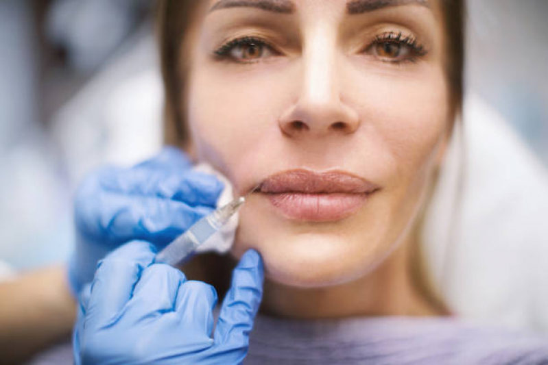 Aplicação de Botox Facial Marajó - Aplicação de Botox na Testa