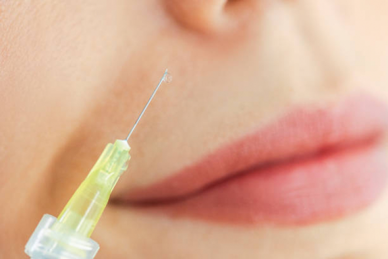 Aplicação de Botox Full Face Califórnia - Aplicação de Botox nos Lábios
