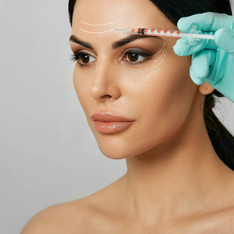 Aplicação de Botox na Testa Agendar Belvedere - Aplicação de Botox nos Lábios