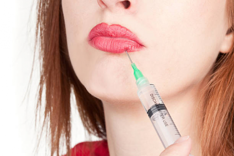 Aplicação de Botox nos Lábios Cabana - Aplicação de Botox na Testa