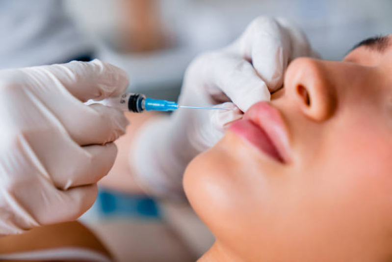 Aplicação de Botox para Rugas Agendar Tiradentes - Aplicação de Botox na Testa