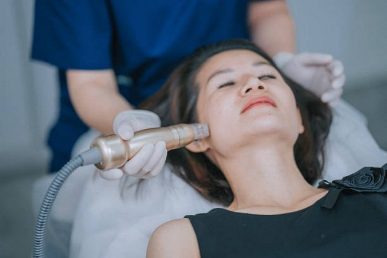 Clínica Especialista em Depilação a Laser no Rosto Santa Maria - Depilação a Laser para Acabar com Os pelos