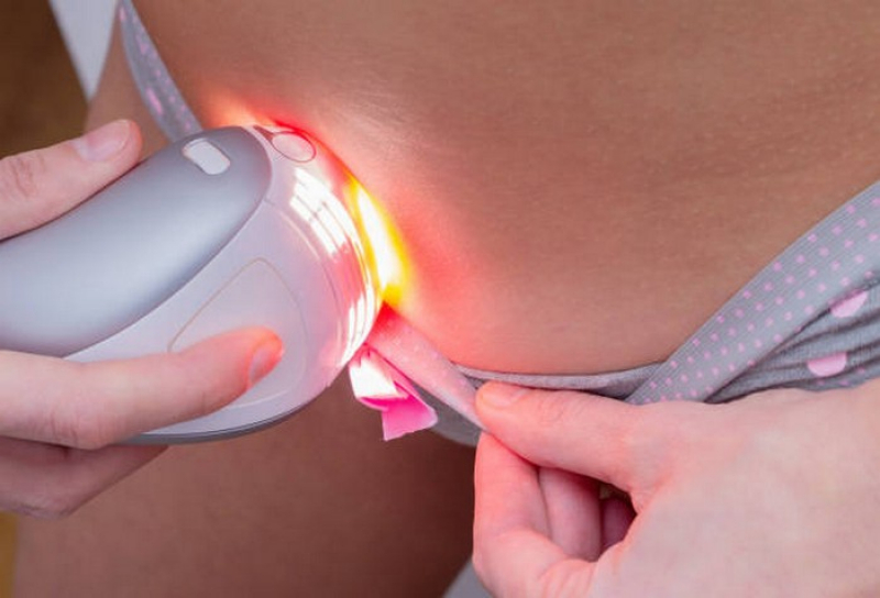 Clínica Especialista em Depilação íntima a Laser São Jorge - Depilação a Laser para Acabar com Os pelos