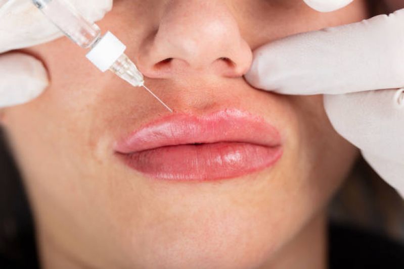 Clínica Que Faz Aplicação de Botox na Boca Contagem - Aplicação de Botox nos Lábios
