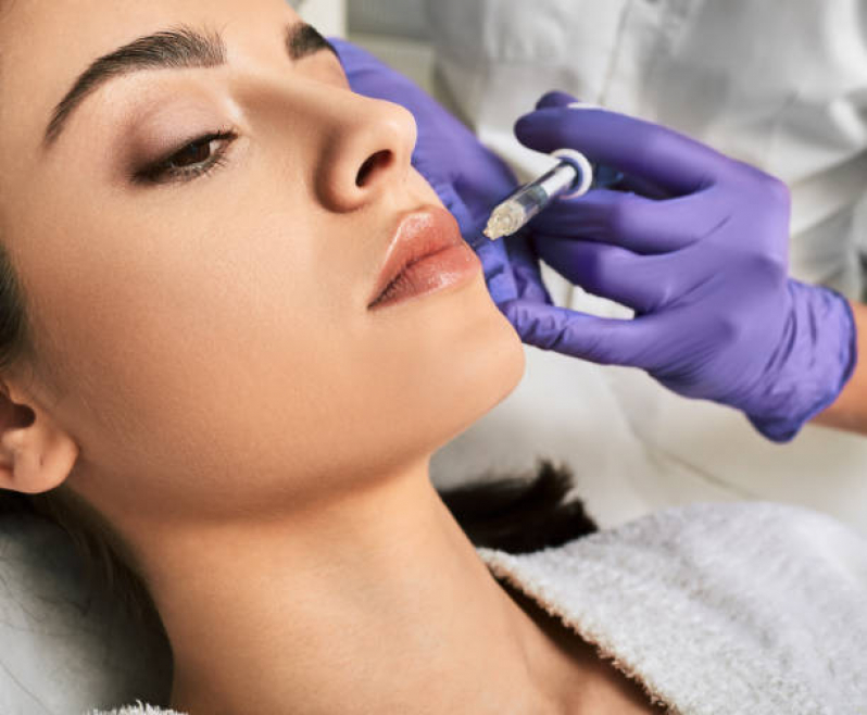 Clínica Que Faz Aplicação de Botox Preenchimento Labial Estoril - Aplicação de Botox na Testa