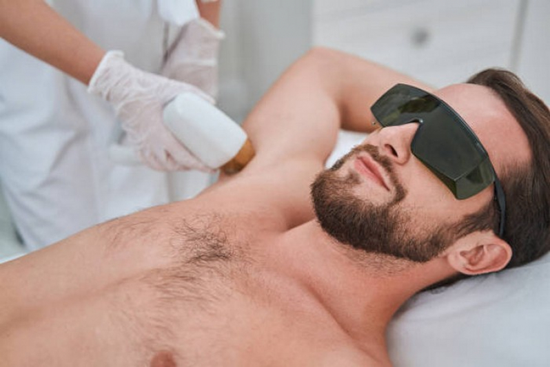 Depilação a Laser Masculina Marcar Santa Efigênia - Depilação a Laser para Acabar com Os pelos