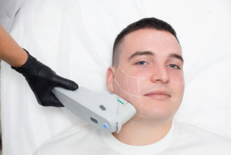 Depilação Masculina Laser Agendar Nova Suíça - Depilação a Laser Masculina íntima