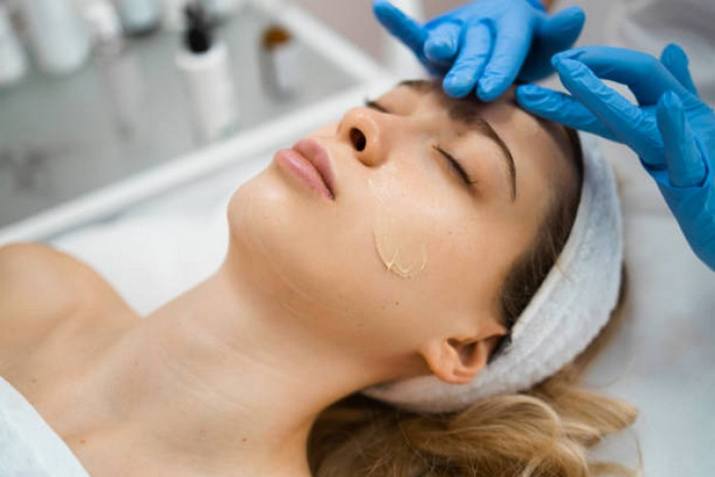 Limpeza de Pele para Acne Agendar Glalija - Limpeza Facial