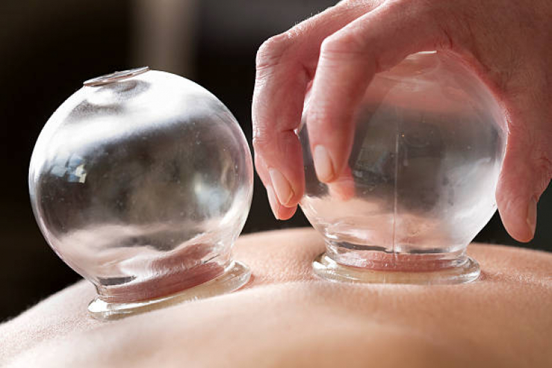 Massagem com Ventosas Contagem - Massagem Ventosa Terapia