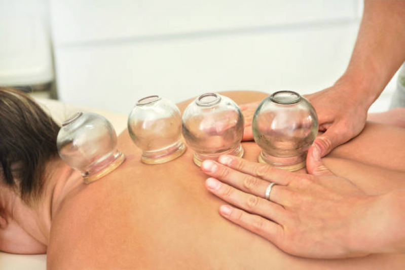 Massagem Relaxante com Ventosaterapia Marcar Santa Helena - Massagem de Ventosa