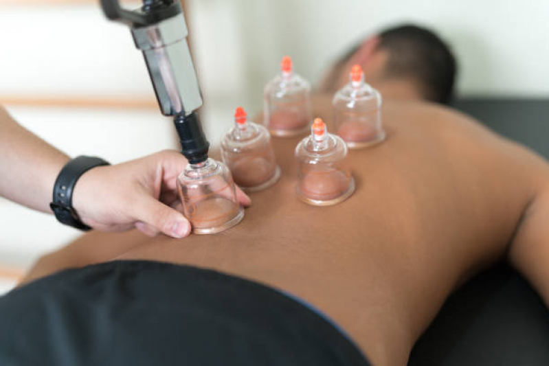 Onde Fazer Massagem de Ventosa Primavera - Massoterapia Ventosaterapia