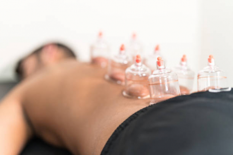 Onde Fazer Massagem e Ventosa São Pedro - Massagem Relaxante com Ventosaterapia