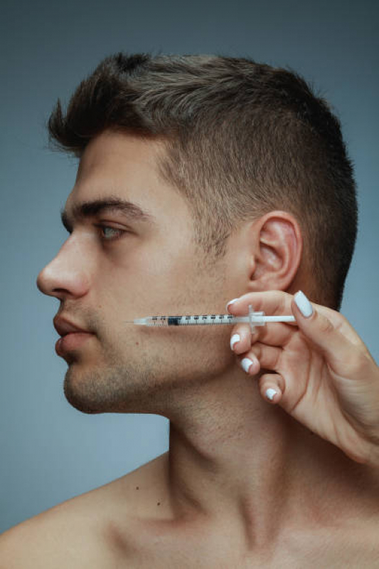 Preenchimento Labial Masculino Agendar Nova Suíça - Preenchimento de Lábios