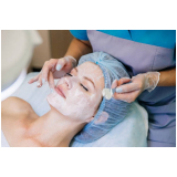 clínica especialista em limpeza de pele para acne Serra