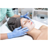 clínica especialista em limpeza de pele profissional Serra