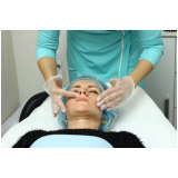 clínica especialista em limpeza de pele profunda para acne Estoril