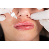 clínica que faz aplicação de botox na boca Savassi