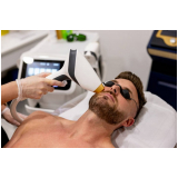 depilação a laser para barba marcar Paraiso