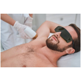 depilação a laser virilha masculina São Vicente