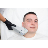 depilação masculina laser agendar Nova Suíça