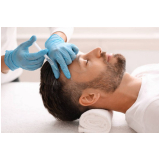 harmonizaçao facial masculina clínica Nova Suíça