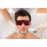 onde faz depilação laser masculinas Carlos Prates