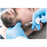 preenchimento de mandibula masculino clínica Estoril