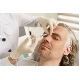 preenchimento mandibular masculino clínica Nova Gameleira